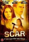 Scar